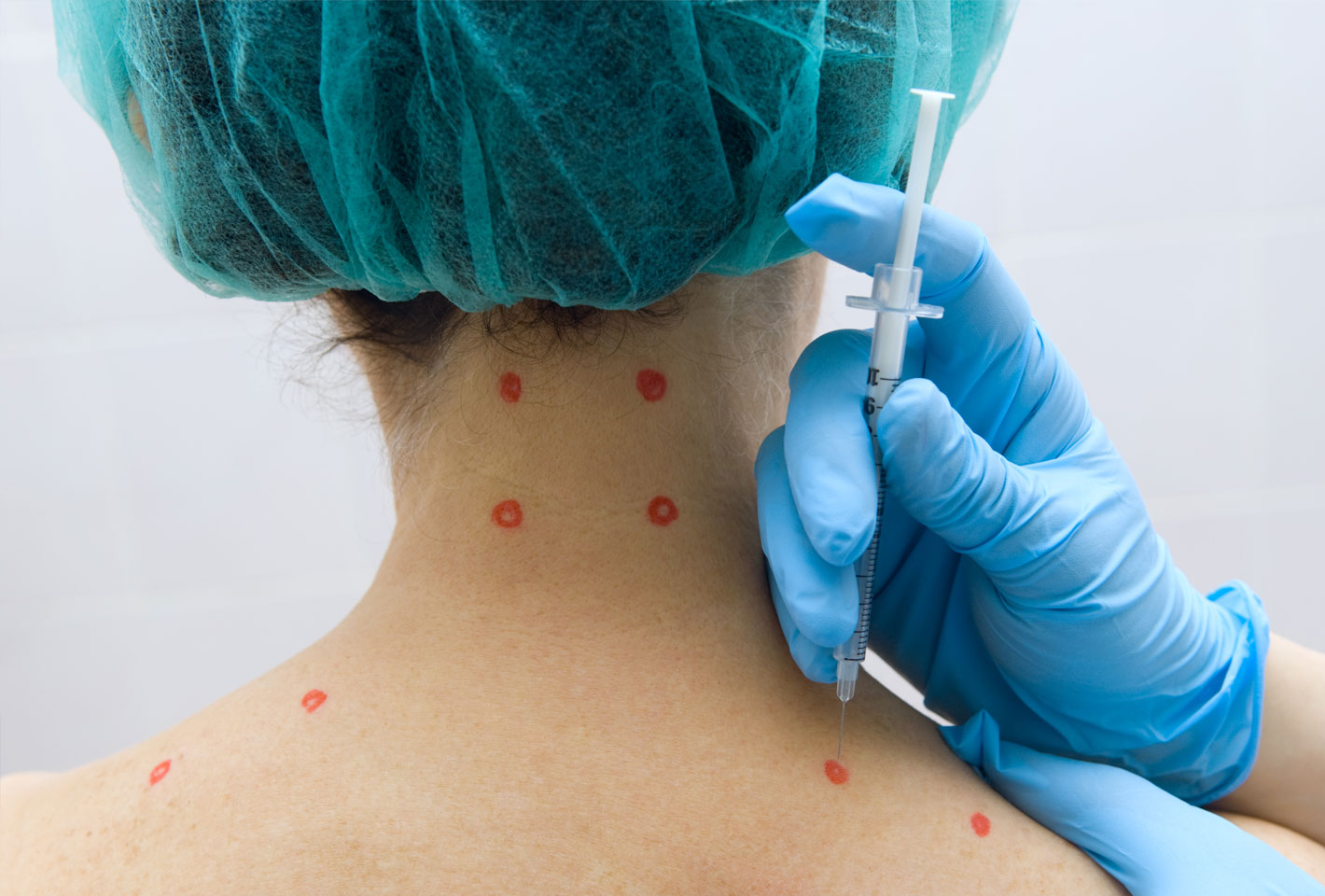 Trigger Point Injections